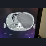 Медосмотр перед устройством на работу спас жизнь молодому человеку