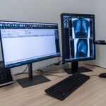 За два года в Новосибирской области заболеваемость туберкулезом уменьшилась втрое